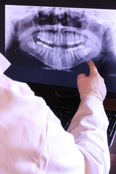 Best Emergency Wisdom Teeth Removal in Piney, AR